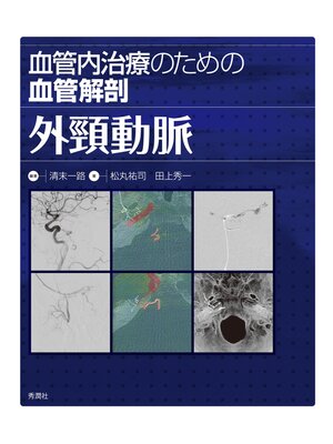 cover image of 血管内治療のための血管解剖　外頸動脈